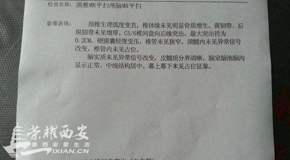 坐办公室未必是好事 毕业两年才24岁就得颈椎