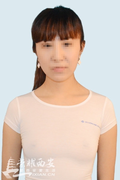 80后女模自曝丰胸手术全过程 小伙伴们快来一