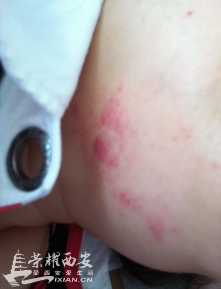 西京医院的保安黑社会打女人 丢你妈的人 大家